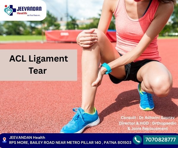 What is an ACL tear?